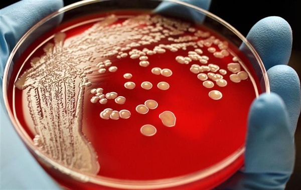 An investigation into the effects of in-feed zinc oxide on antimicrobial resistant bacteria