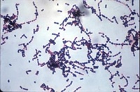Evaluation and improvement of Streptococcus suis bacterins