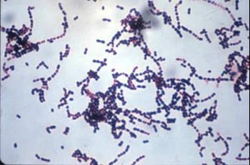 Evaluation and improvement of Streptococcus suis bacterins